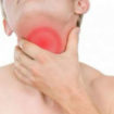 laryngitis