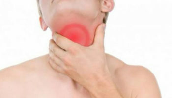 laryngitis