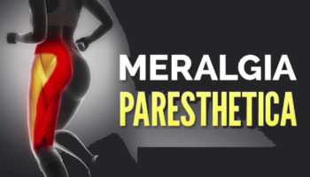meralgia paresthetica relief