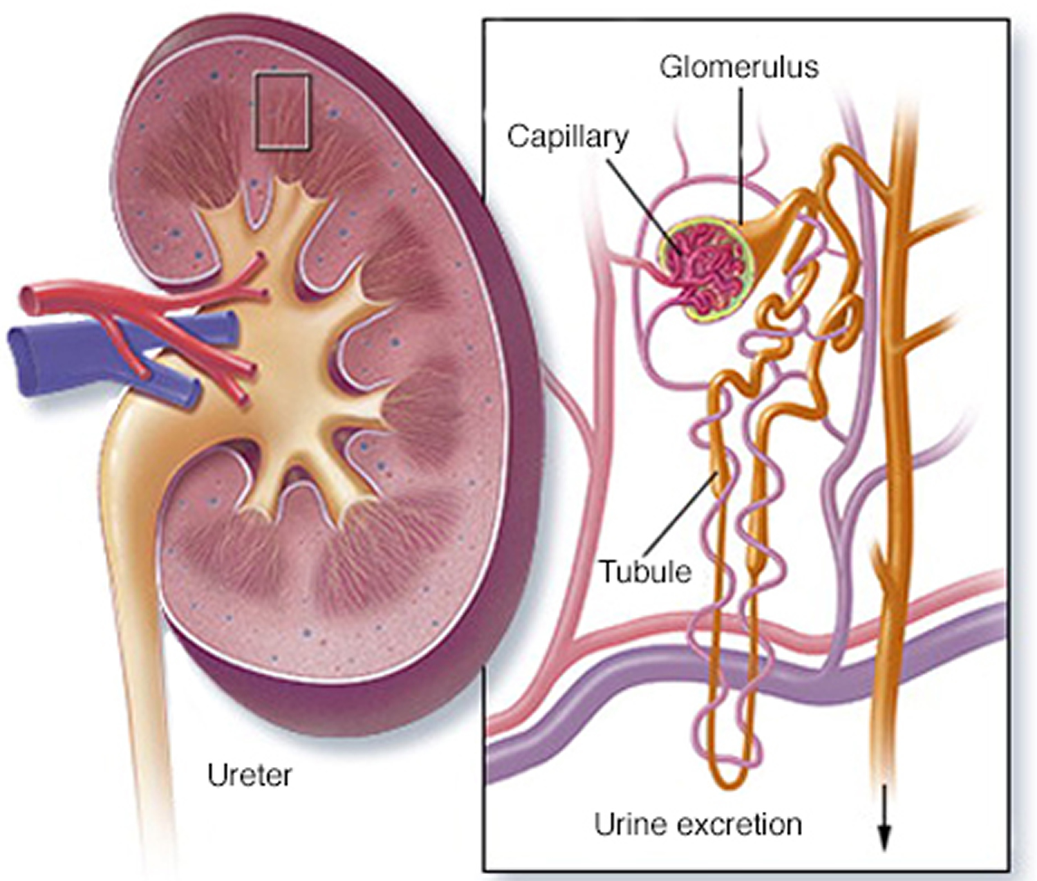 presentation of nephrotic syndrome