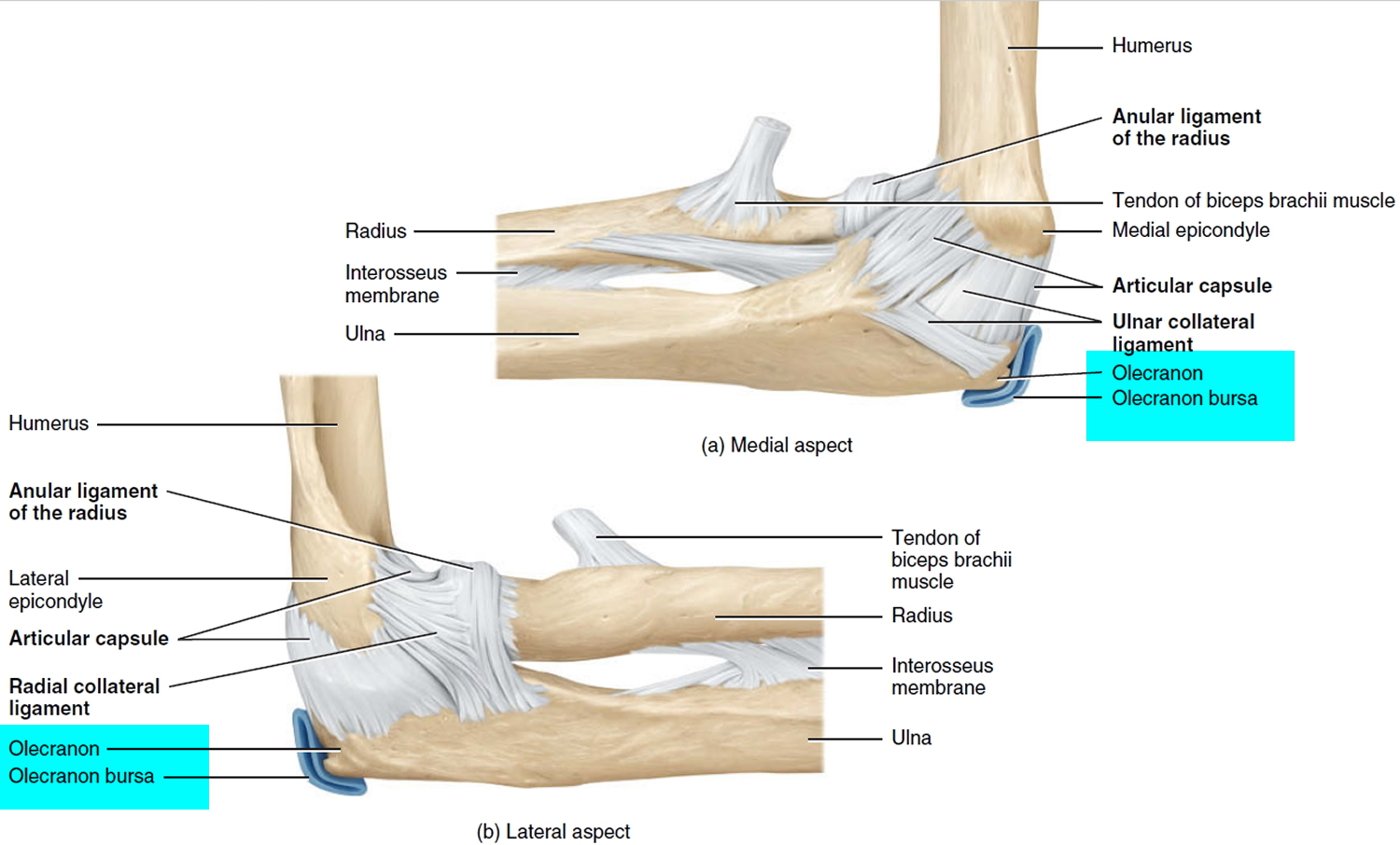 olecranon bursitis