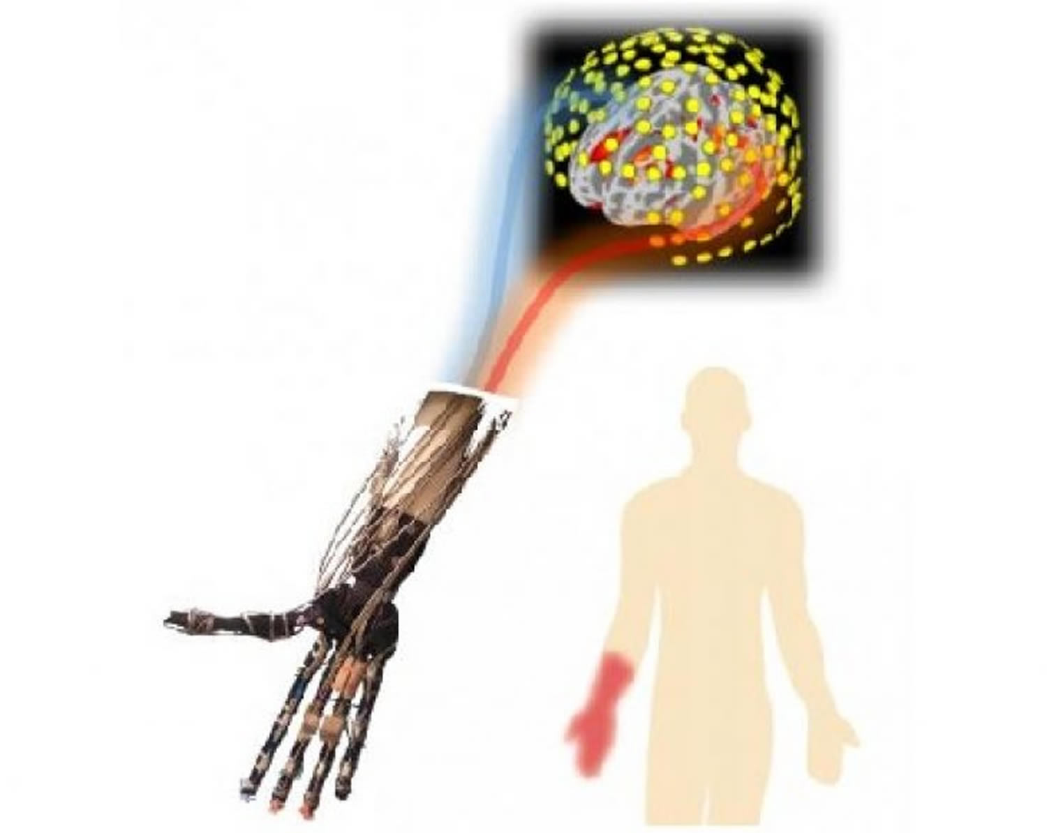 Phantom Pain Causes Symptoms Phantom Pain Treatment