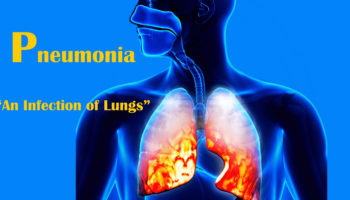 pneumonia