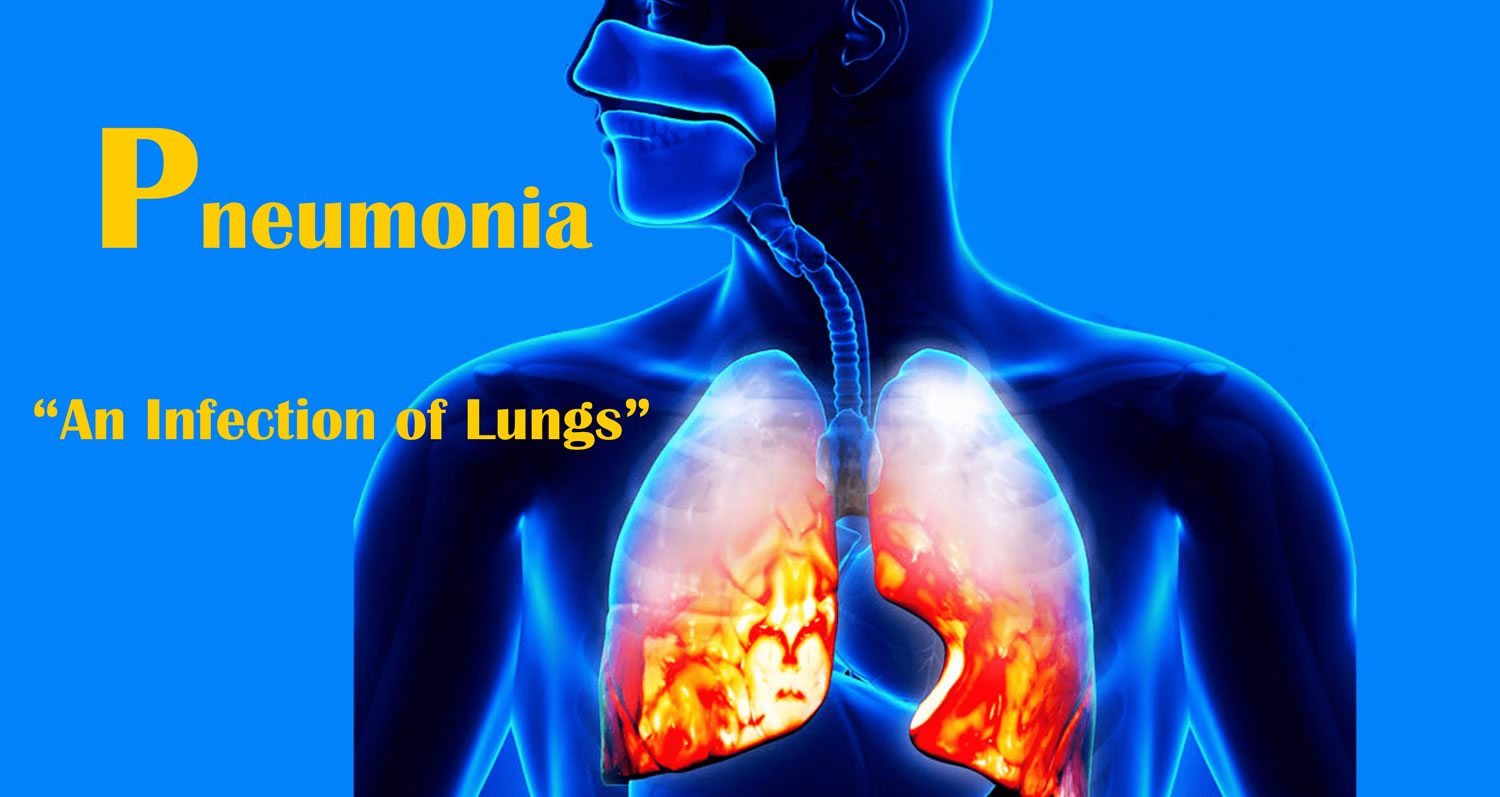 how lungs fluid in does get Signs, Pneumonia & Pneumonia Shot Symptoms, Causes,