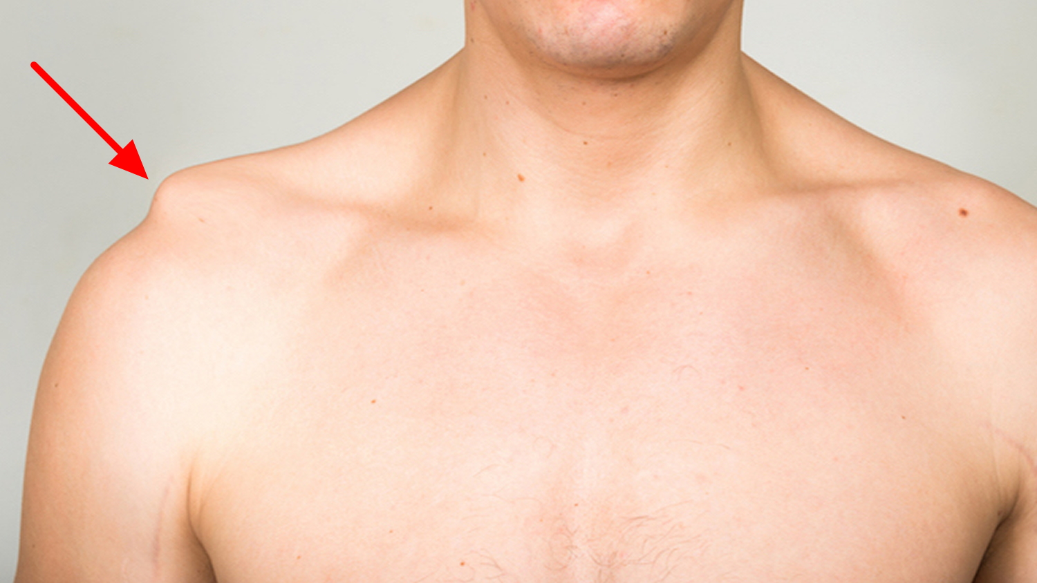 ямки на груди у мужчин фото 46