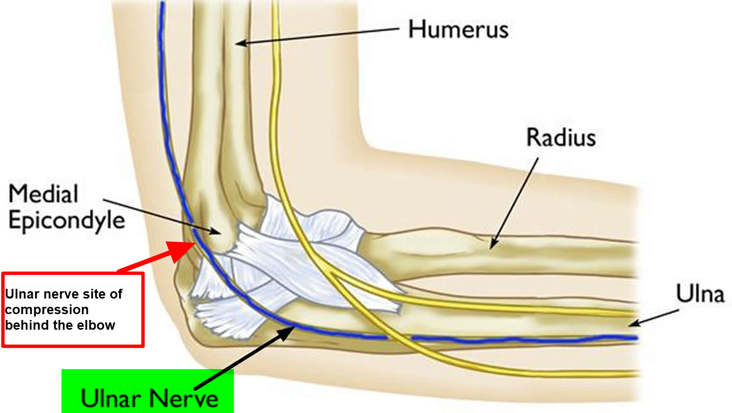 Pinched Nerve In Neck Arm Shoulder Causes Symptoms Treatment