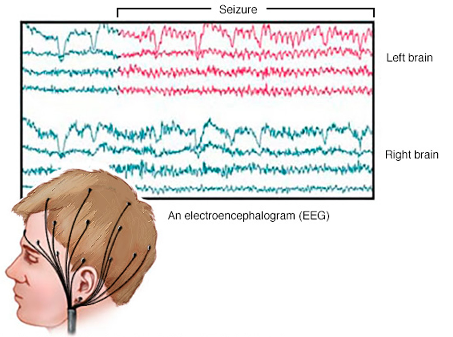 EEG brain activity