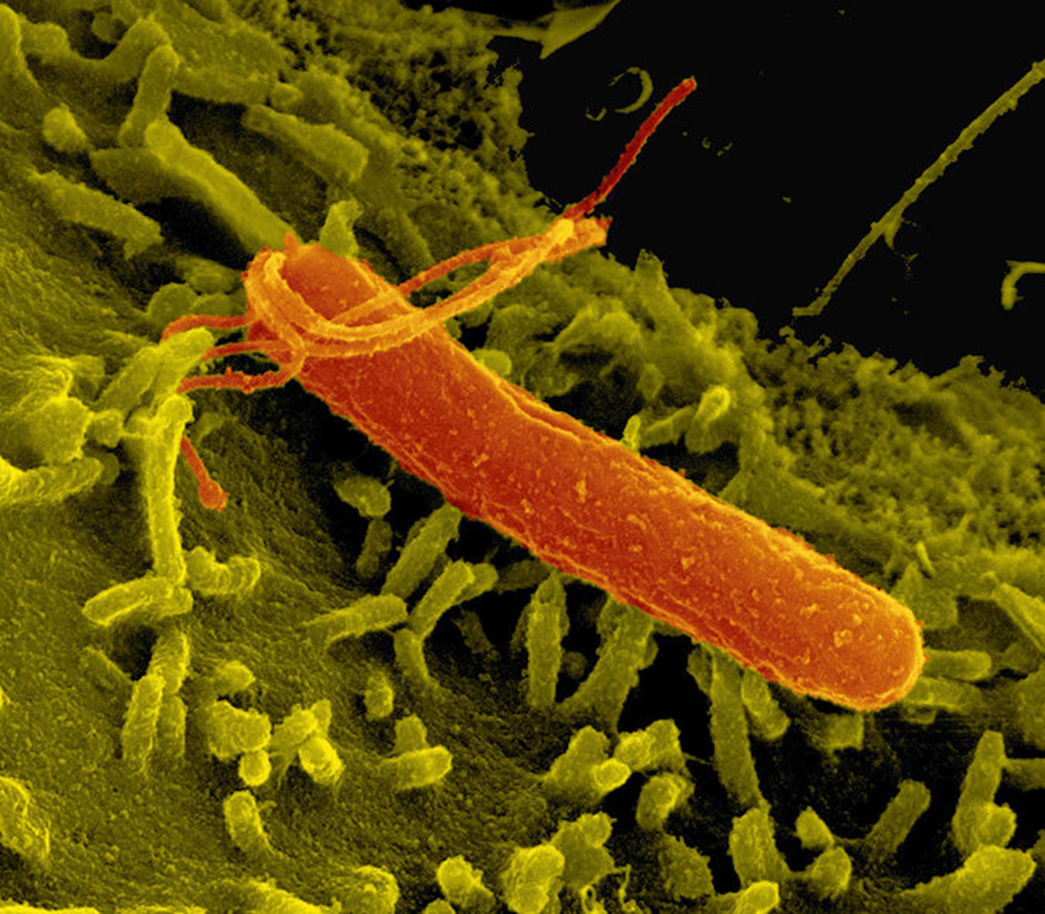 Бактерия вызывающая язву. Гастрит бактерия Helicobacter.