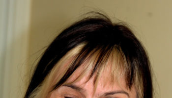 Hemifacial spasm