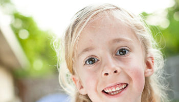 Prader-Willi syndrome
