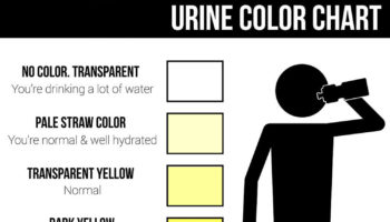 Urine color chart