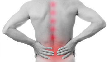 ankylosing spondylitis