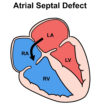 atrial septal defect