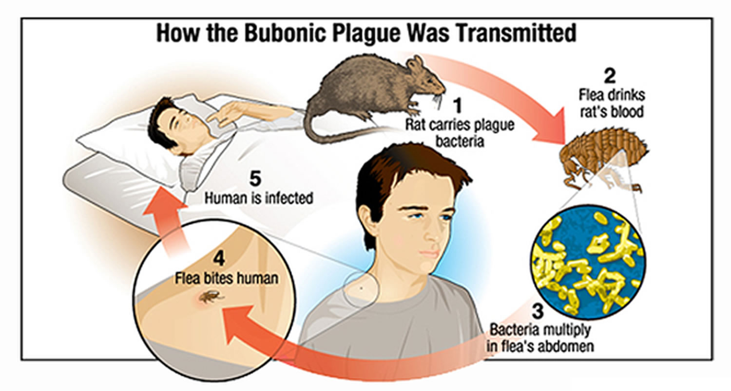 Bubonic Plague Recent Cases 2024 July And August 2024 Calendar