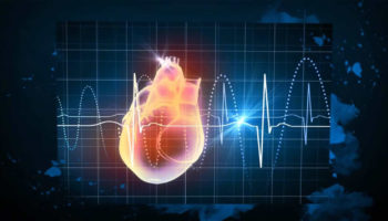 ectopic heartbeat