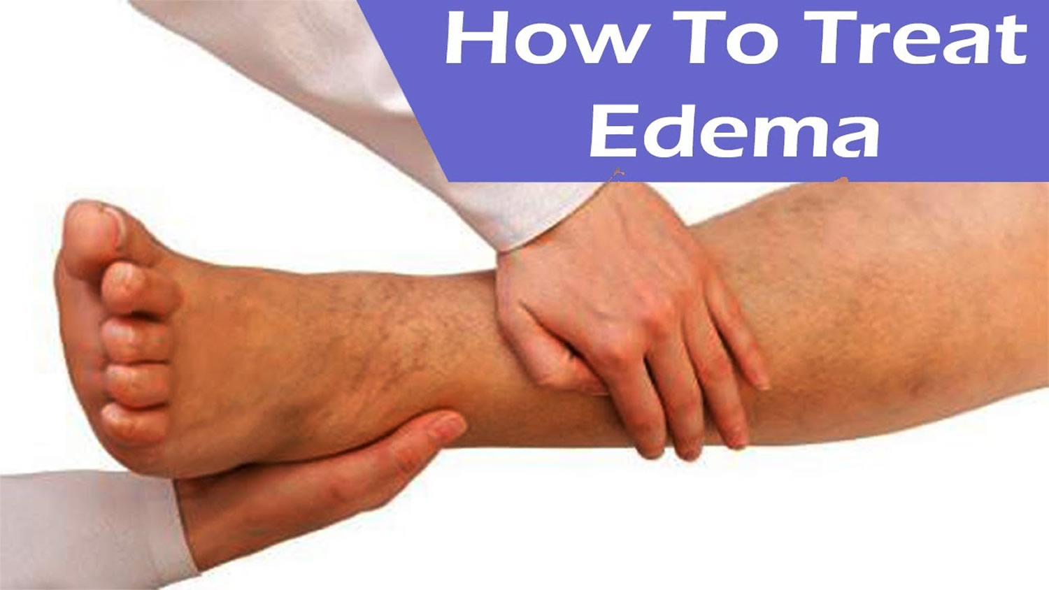 edema-causes-flash-pulmonary-corneal-peripheral-treatment