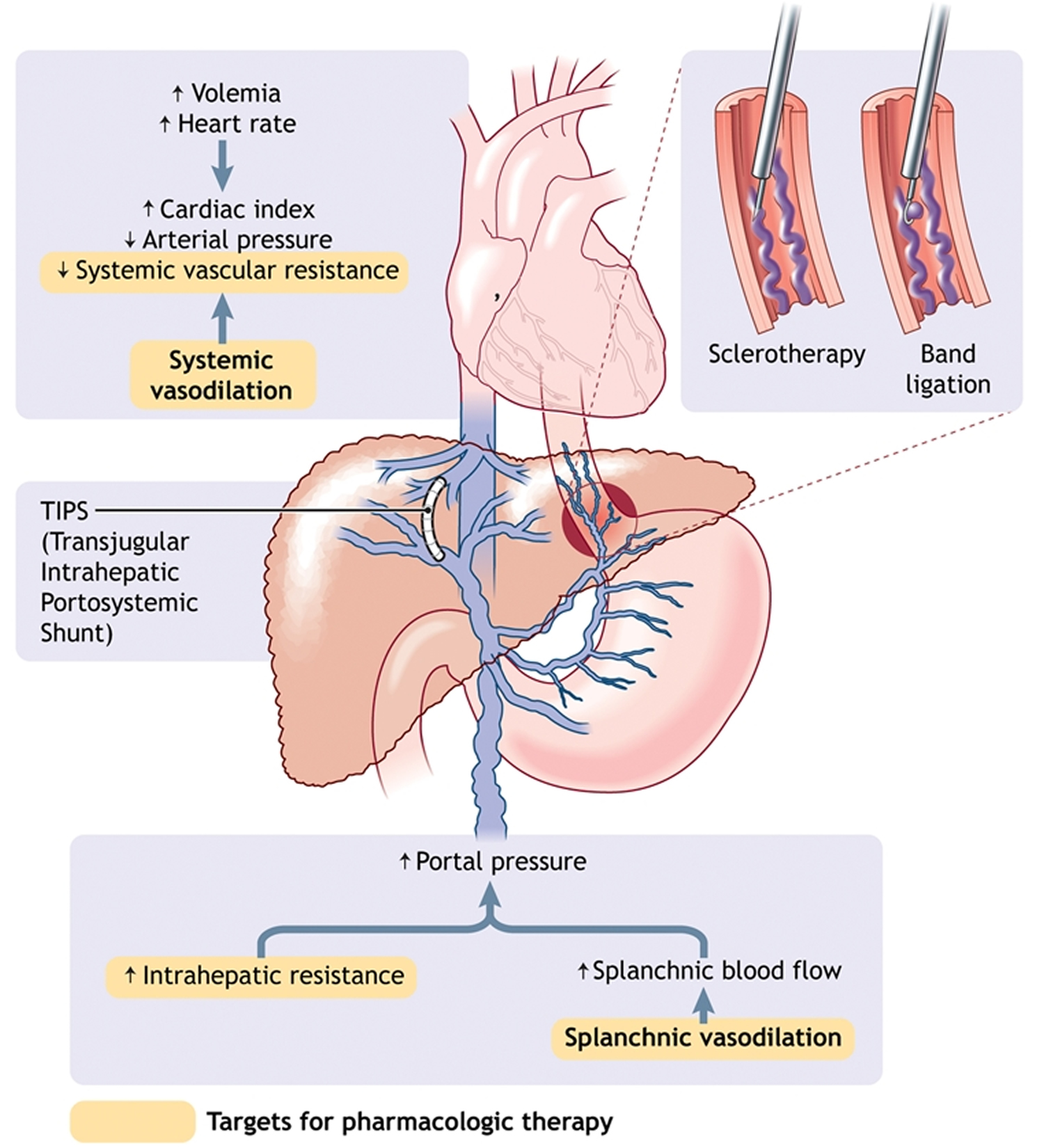 esophageal-varices-causes-symptoms-grading-diagnosis-treatment