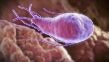 giardiasis