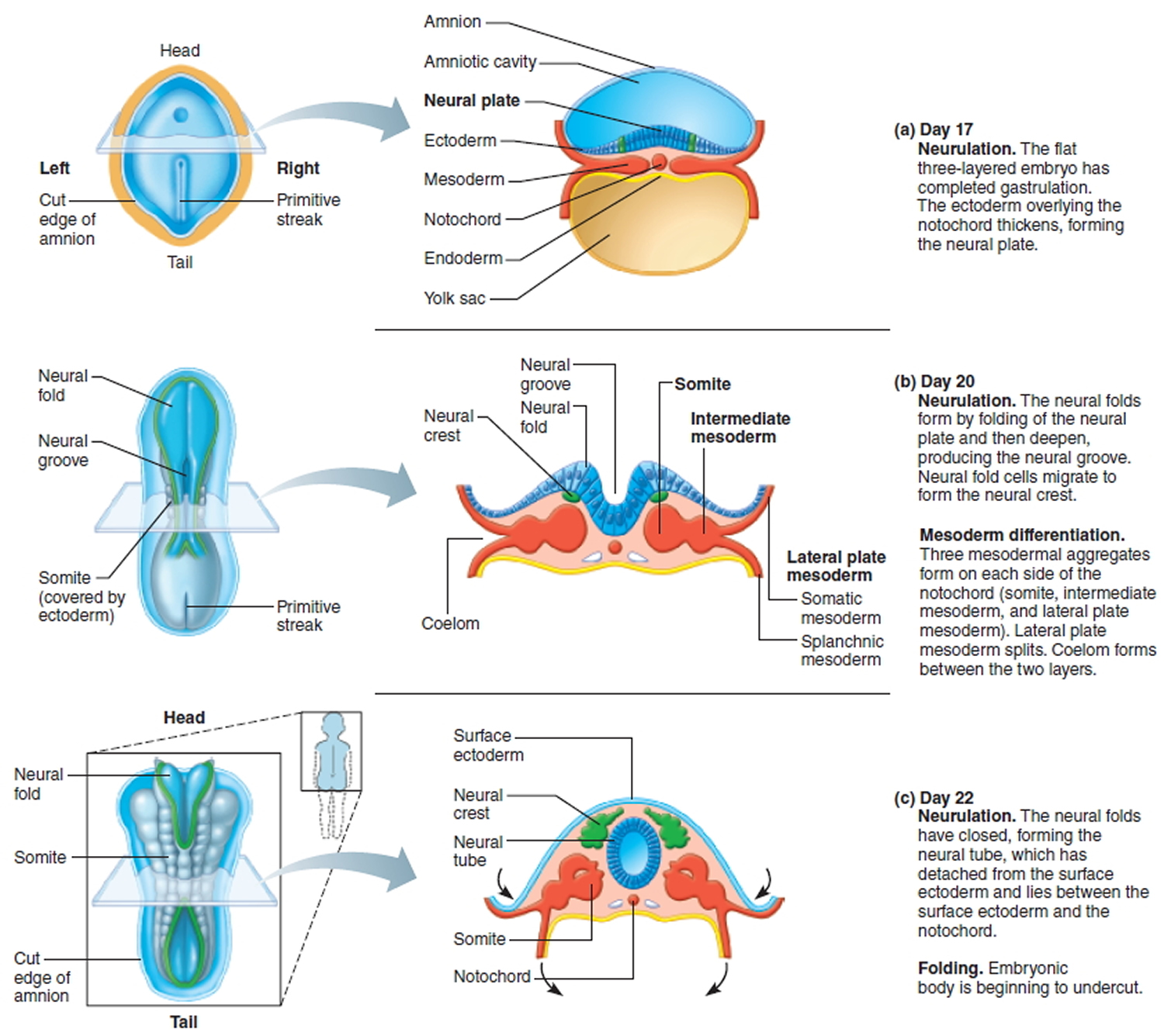 Neural tube defects definition, causes, diagnosis, screening & treatment