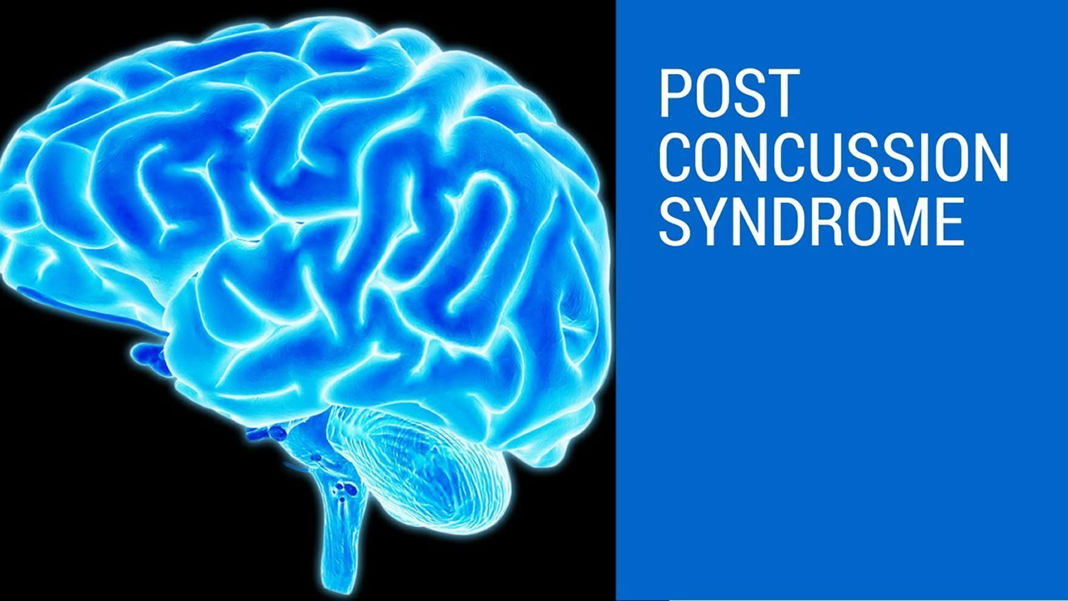 Post concussion syndrome.