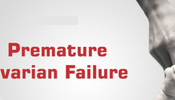 premature ovarian failure