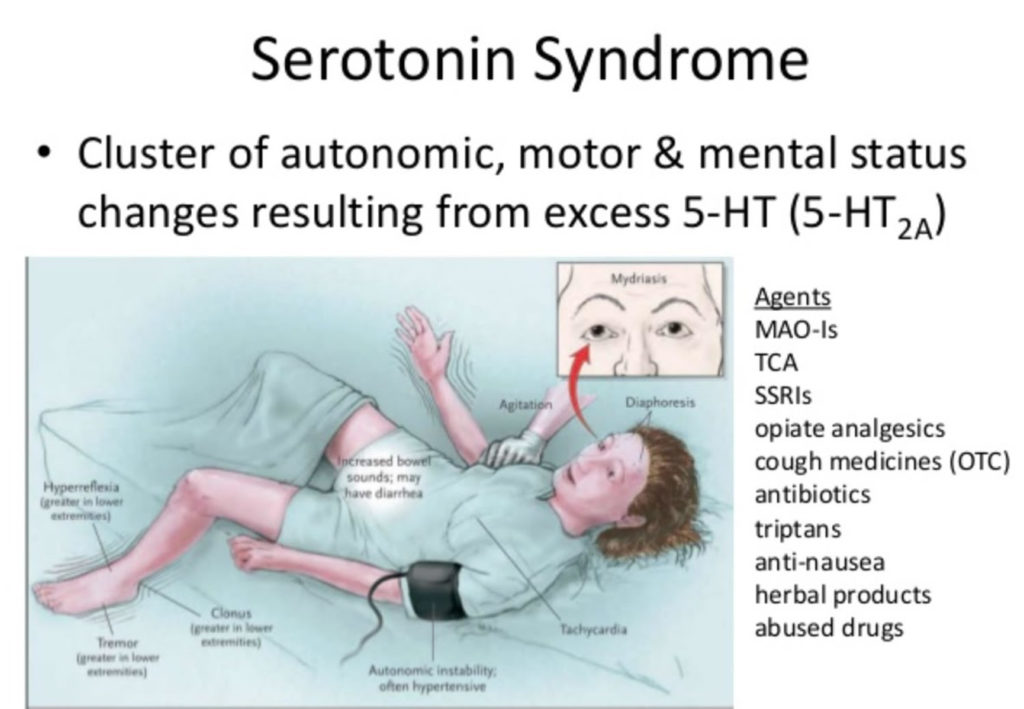 Serotonin Syndrome - Causes, Signs, Symptoms, Duration, Treatment