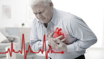 tachycardia