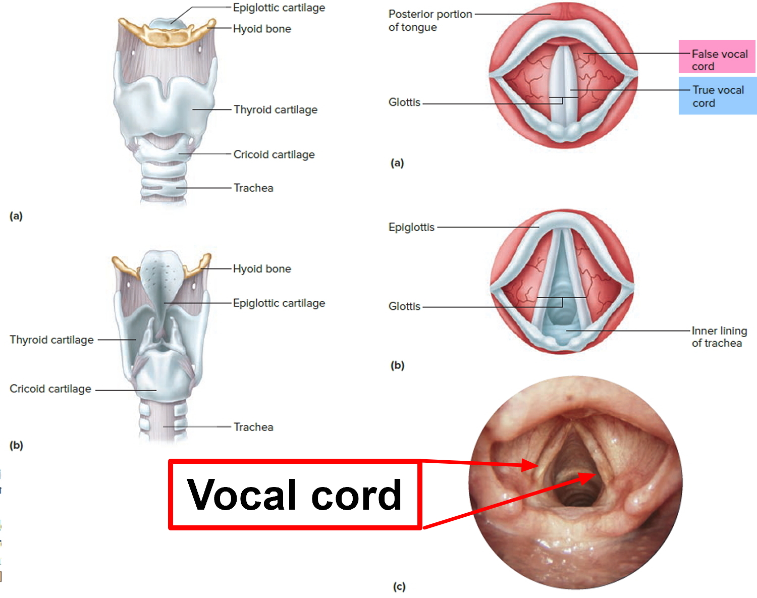 Vocal Cord Injury After Thyroid Surgery