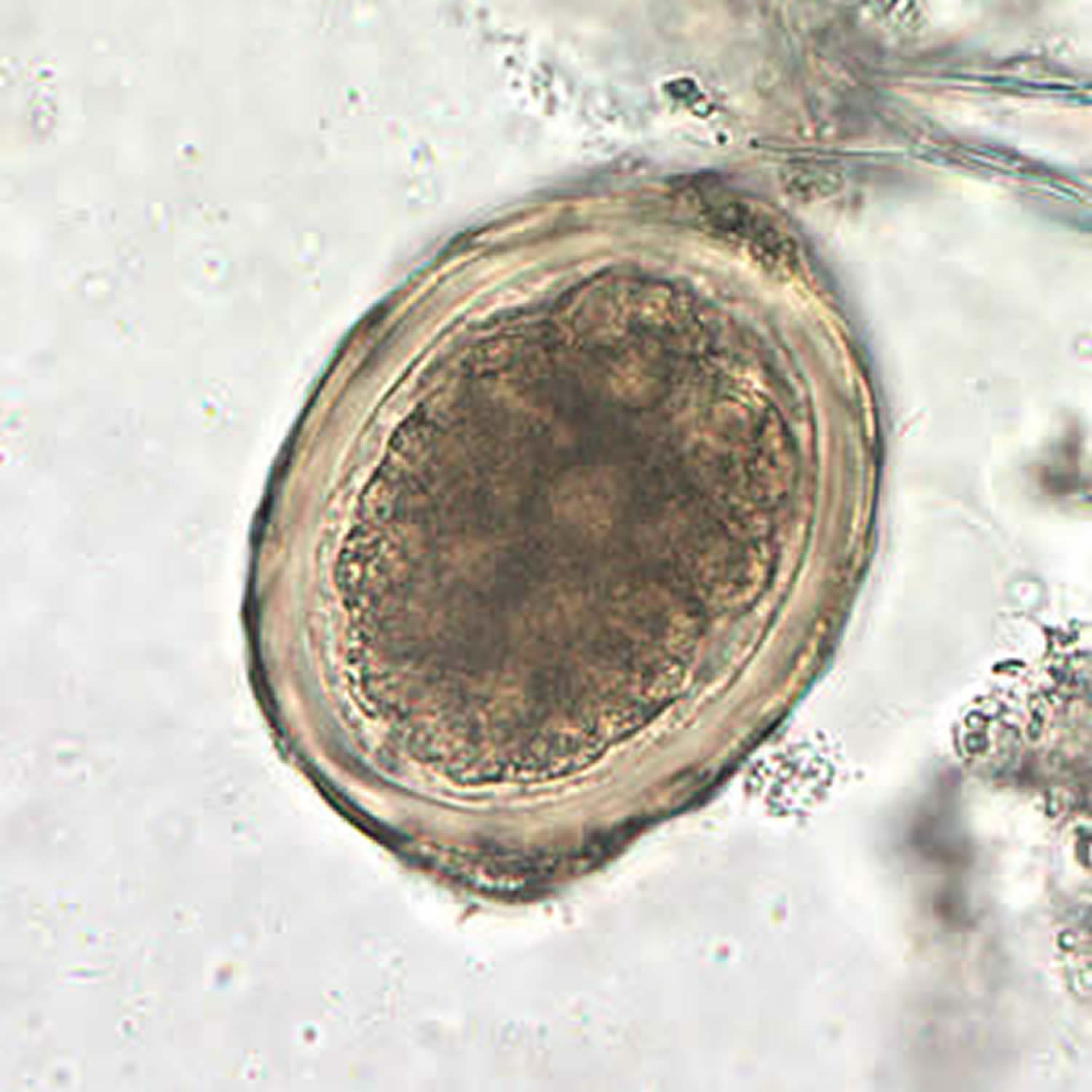 Яйца Аскариды Под Микроскопом - HD фотoграфии