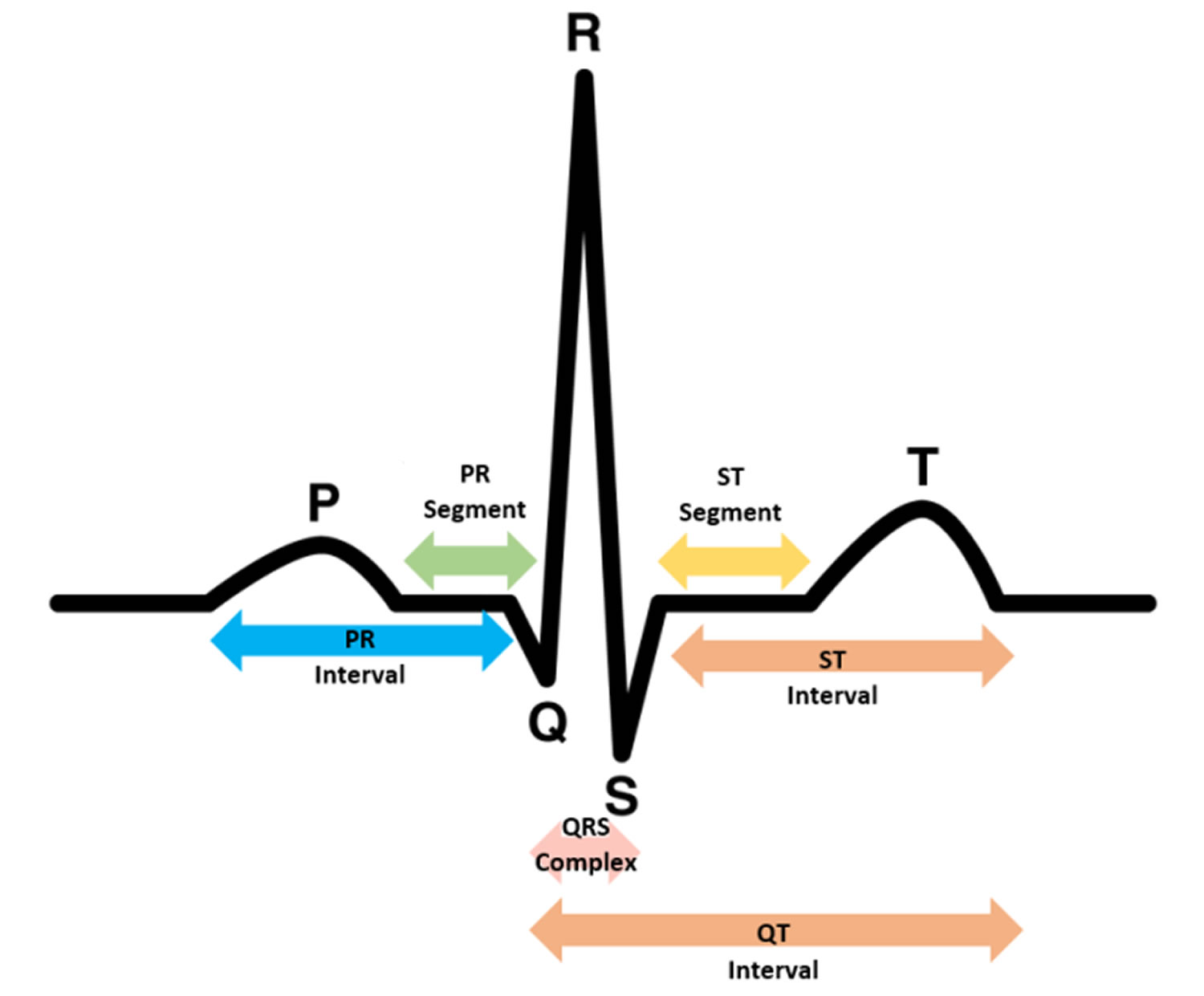 Normal Ecg Waves Of An Ekg | Images and Photos finder