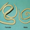 ascariasis