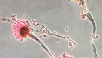 aspergillus