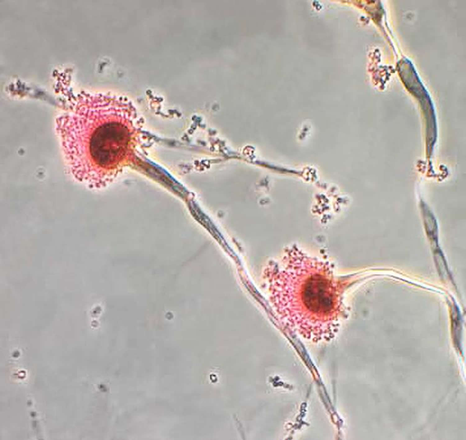 aspergillus