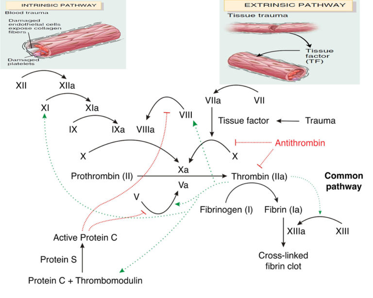 Factor V Leiden - Mutation, Symptoms, Pregnancy, Diagnosis & Treatment