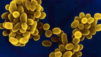 brucellosis