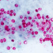 cryptosporidium