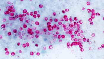 cryptosporidium