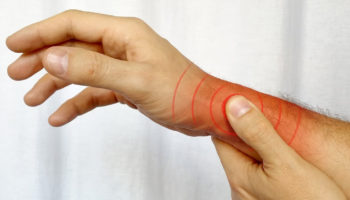 de quervain’s tenosynovitis 1