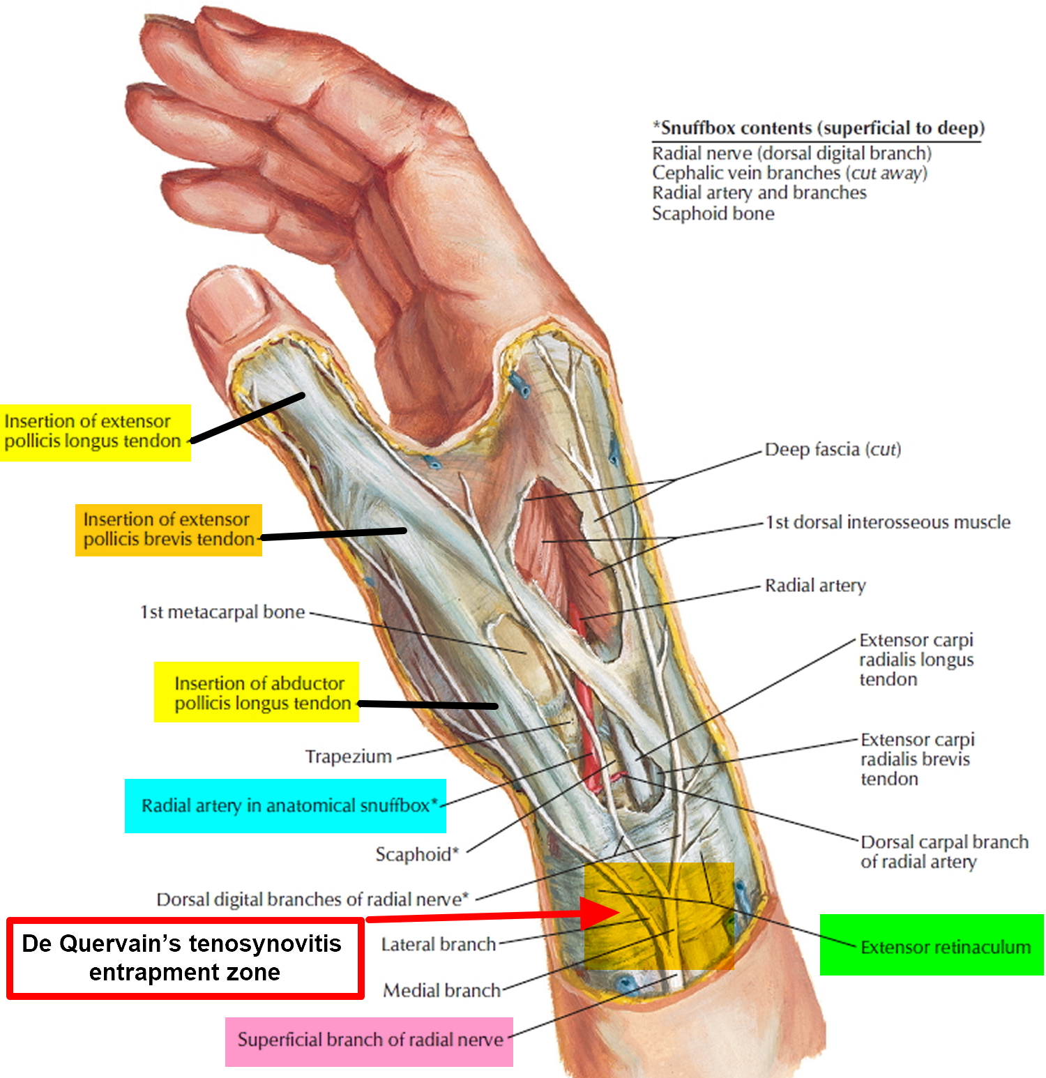 De Quervains Tenosynovitis Causes Symptoms Test Exercise Surgery 7978