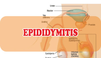 epididymitis