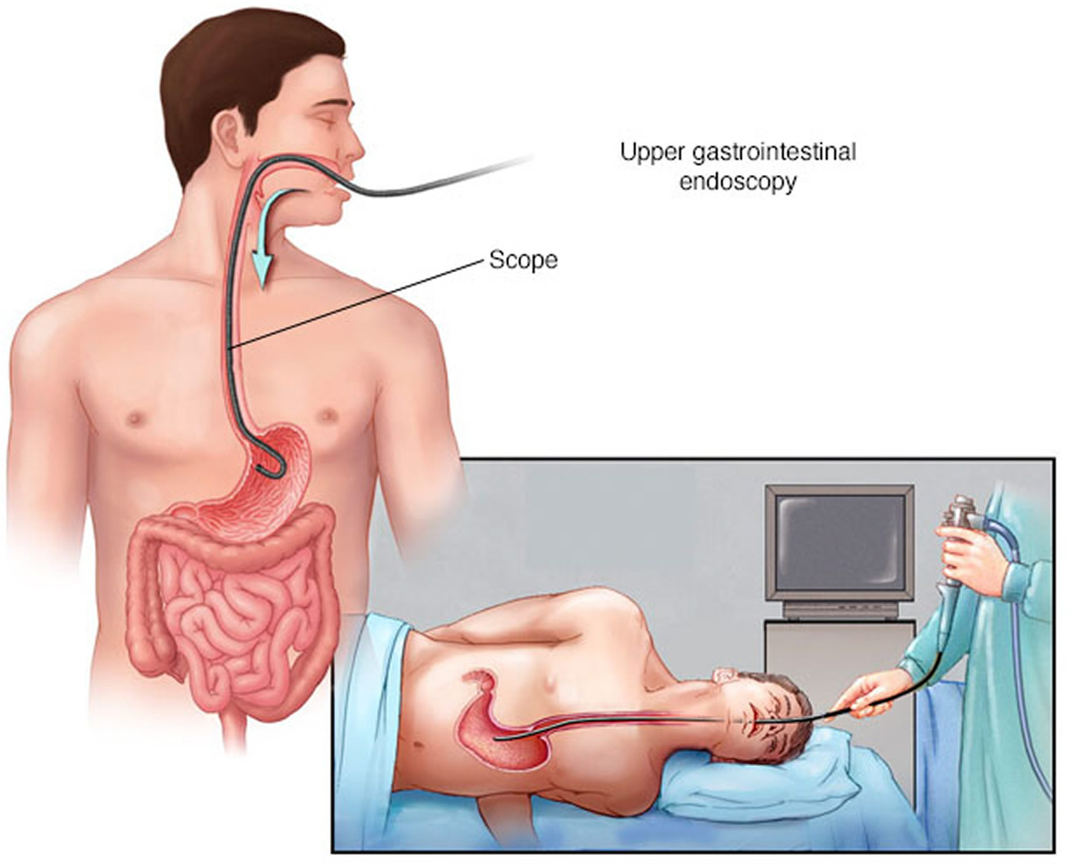 esophagogastroduodenoscopy