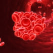 factor v leiden