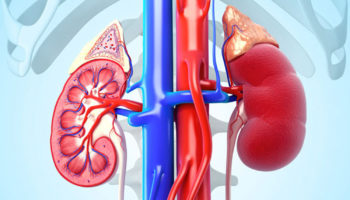 glomerulonephritis
