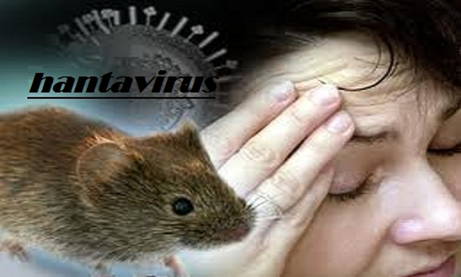 Causes And Symptoms Of Hantavirus Pulmonary Syndrome