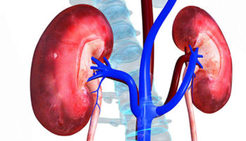 hemolytic uremic syndrome
