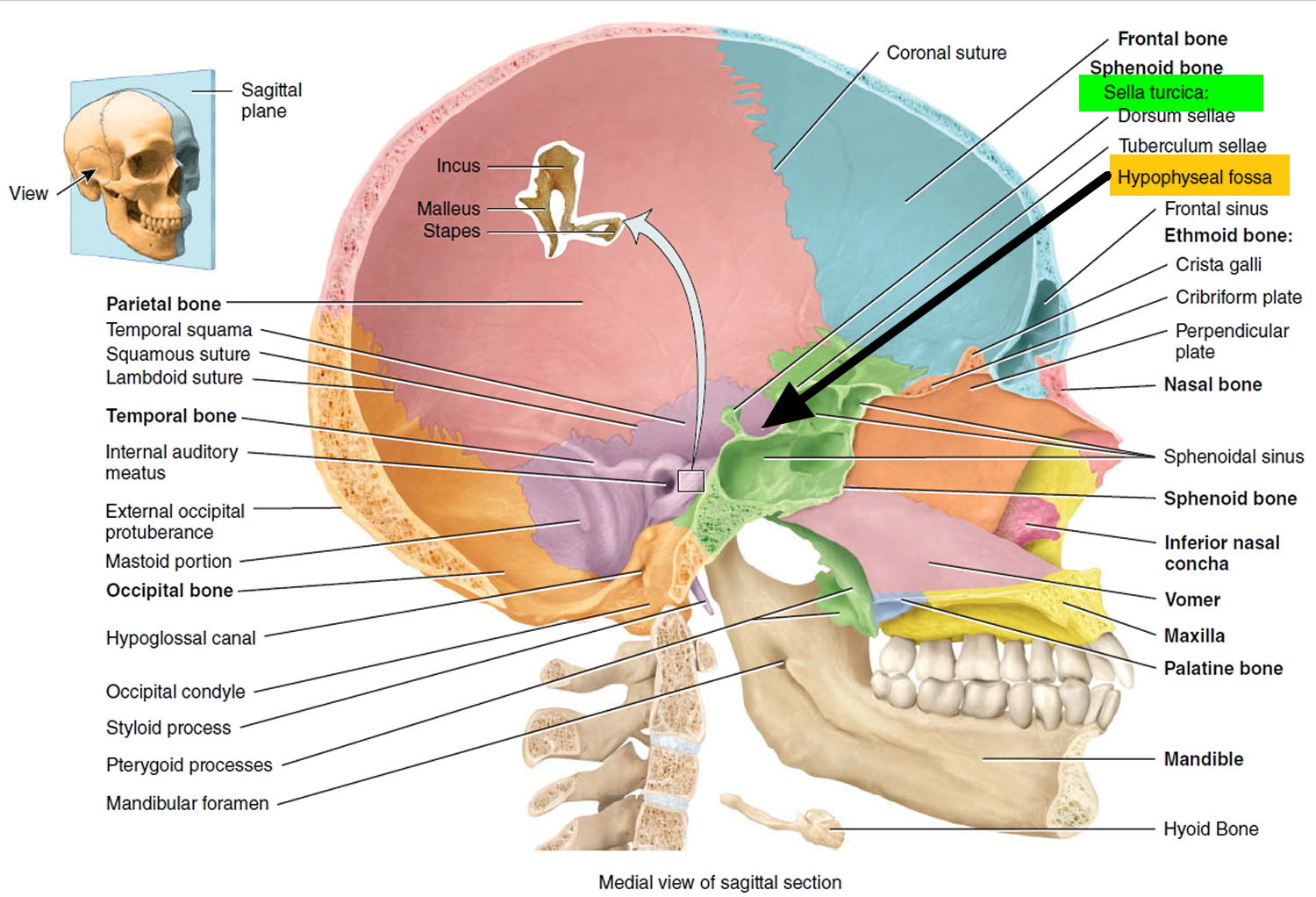 pituitary-tumor-signs-symptoms-diagnosis-mri-surgery-treatment