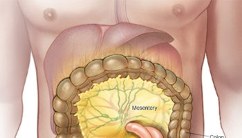 mesenteric lymphadenitis