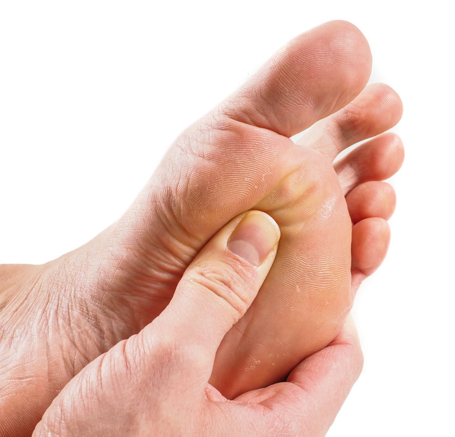 Bunion Metatarsal Pain at Wise blog