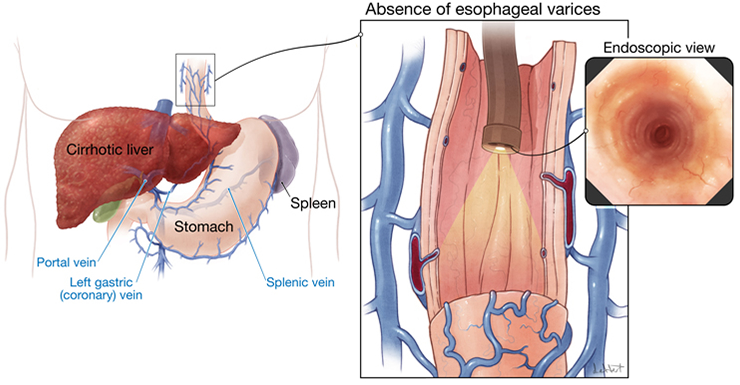 normal esophagus - endoscopy