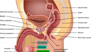 orchitis